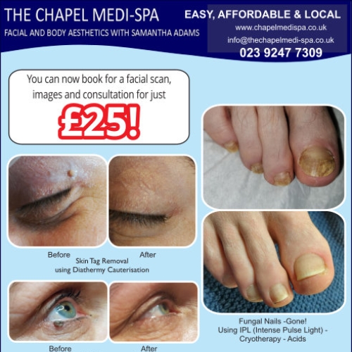 Chapel Medi Spa advert